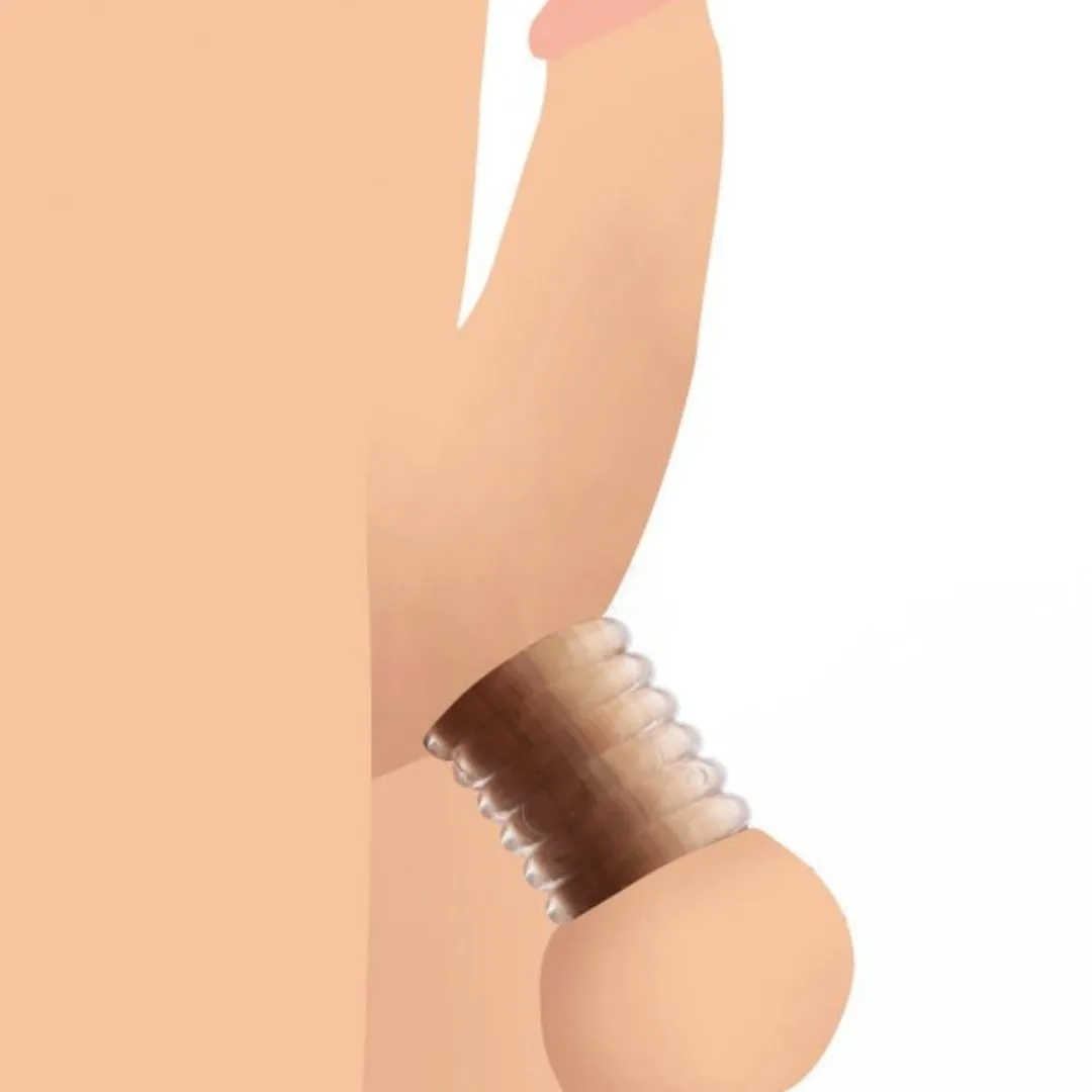 Add a Ring Custom Ball Stretcher Kit